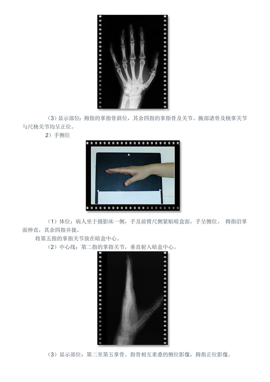 四肢摄影检查技术_第2页