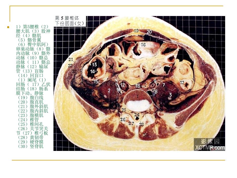 人体断层解剖图谱(盆腔)_第3页