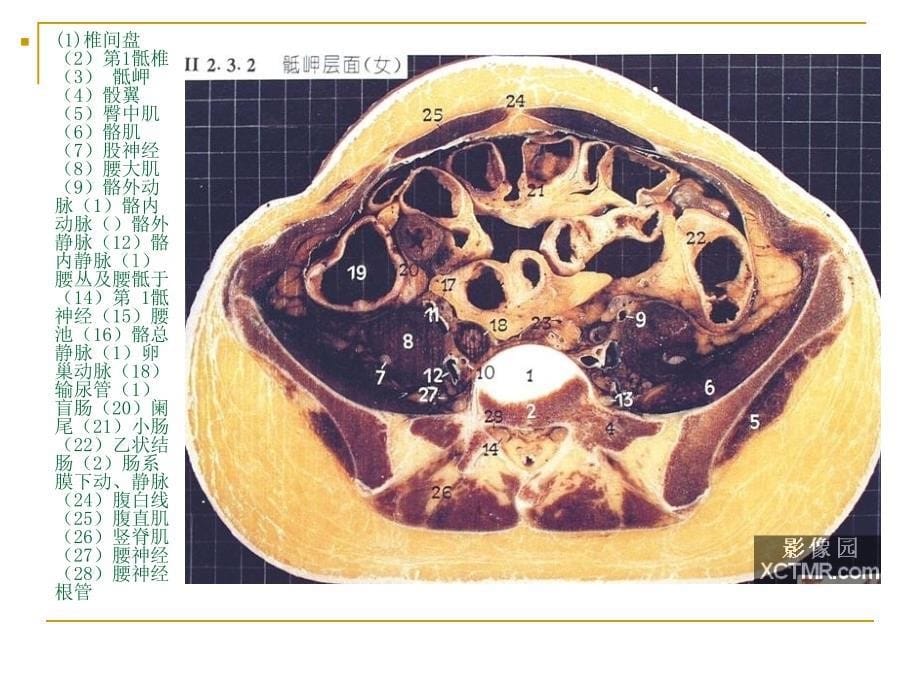 人体断层解剖图谱(盆腔)_第5页