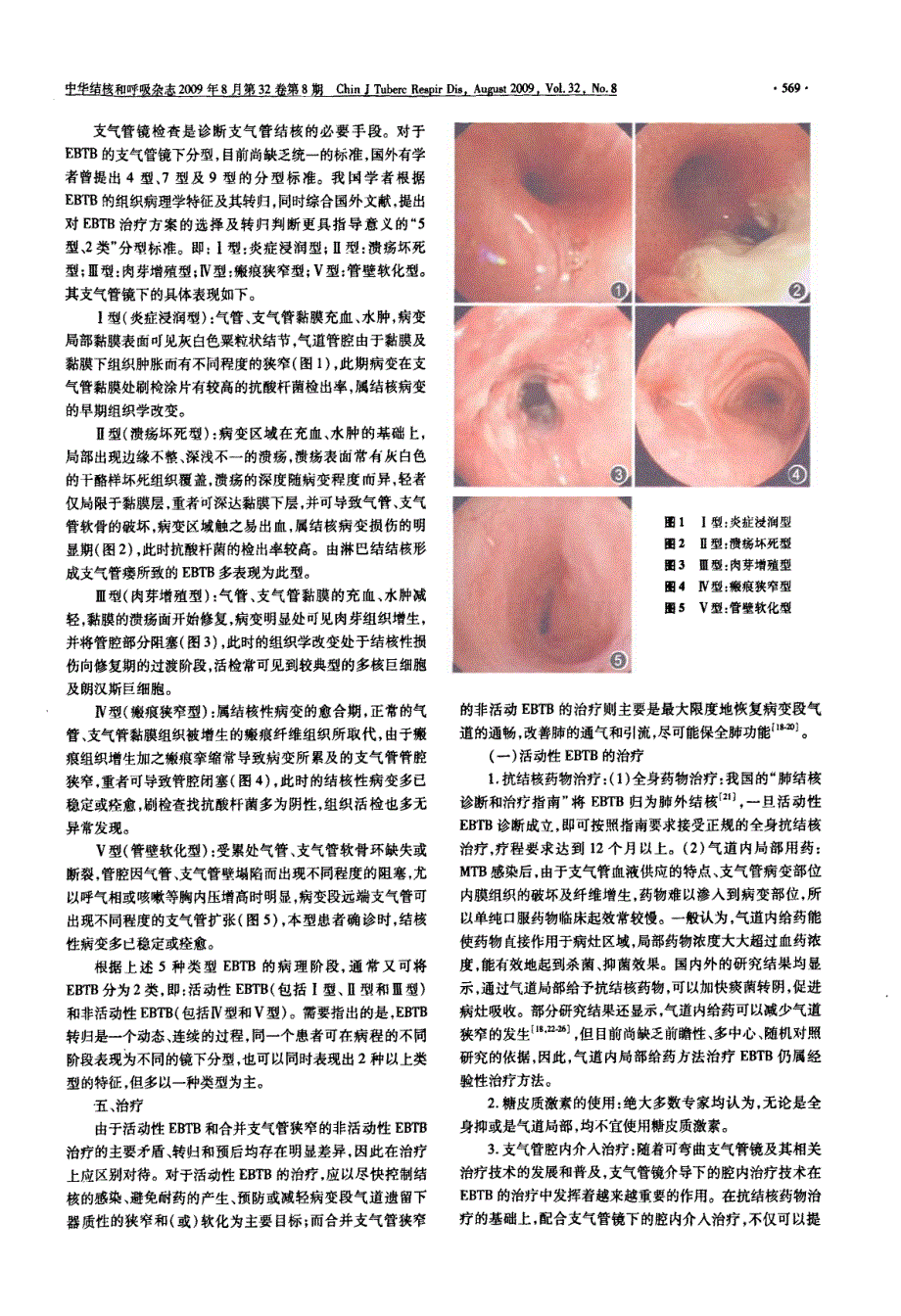 支气管结核的几点专家共识_第2页