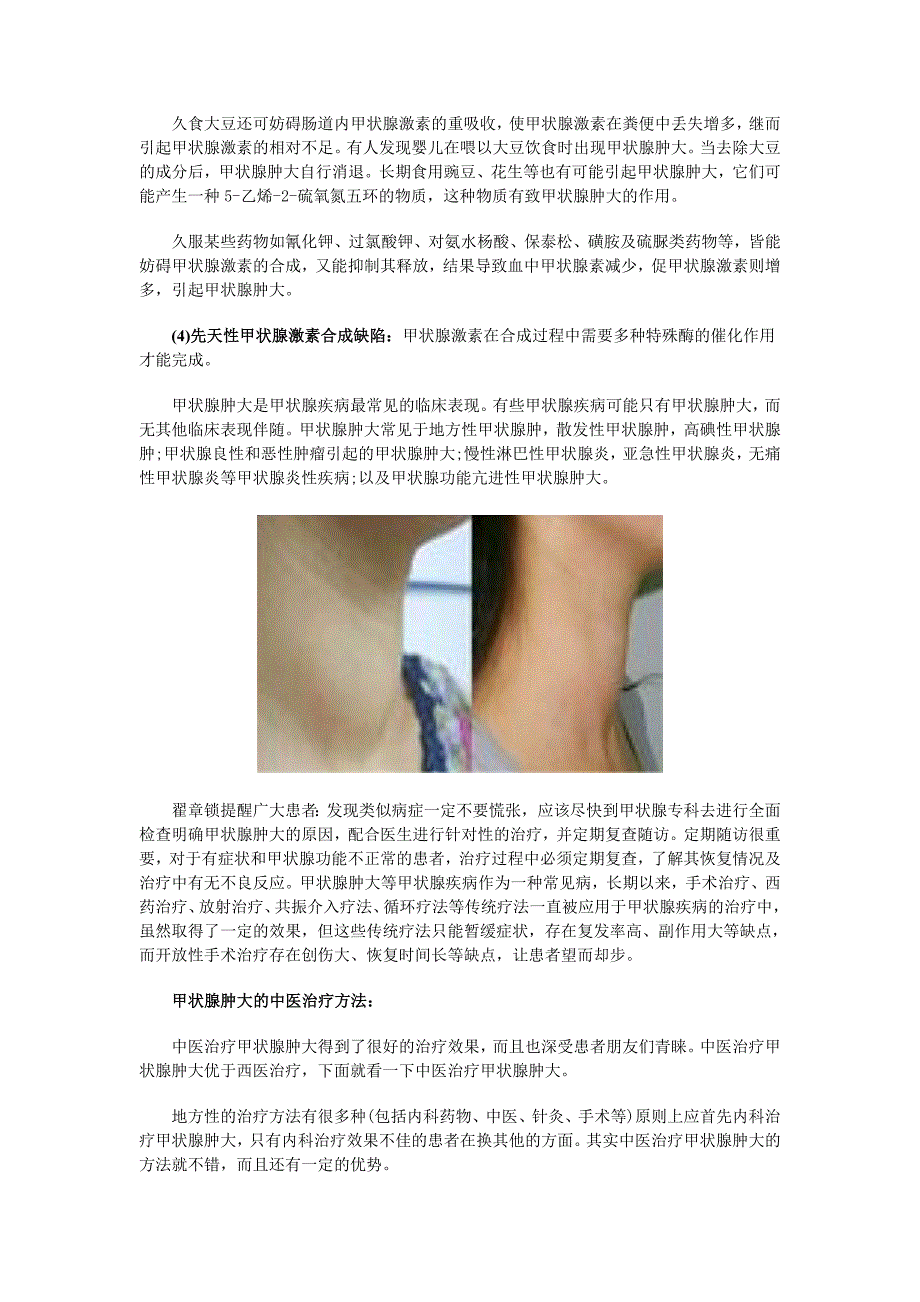 中医治疗甲状腺肿大_第2页