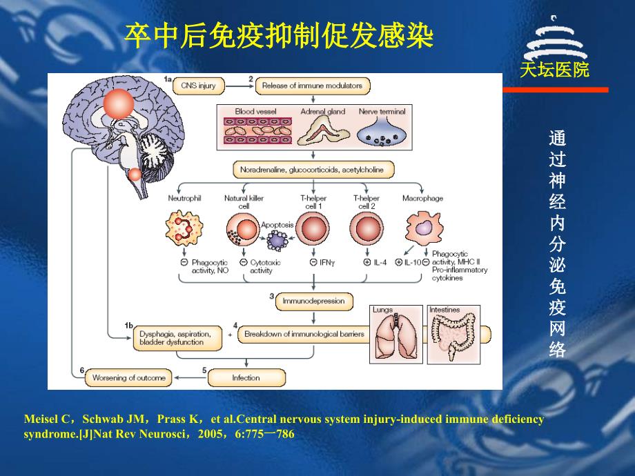 卒中相关性肺炎_第4页