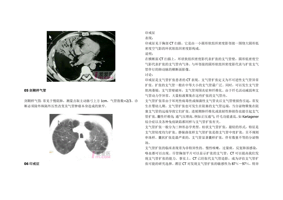 医学影像学各种“征象”综合_第3页