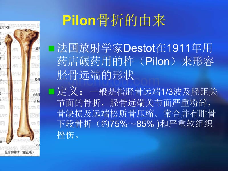 pilon骨折的疗效分析_第2页