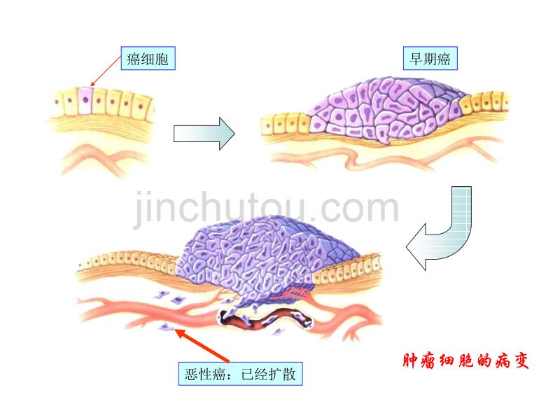 九年级科学非传染性疾病2_第5页