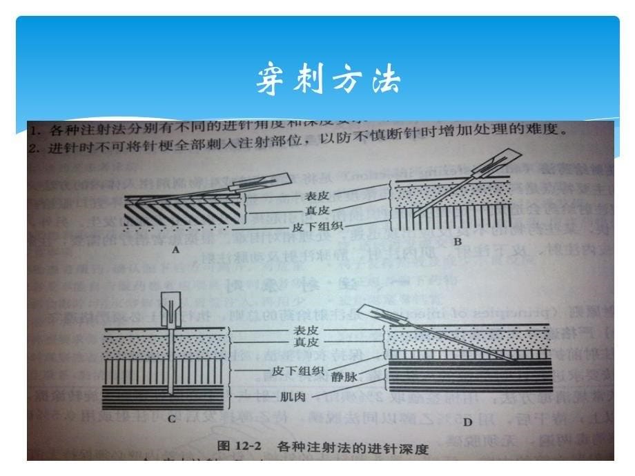 血友病的家庭治疗_第5页