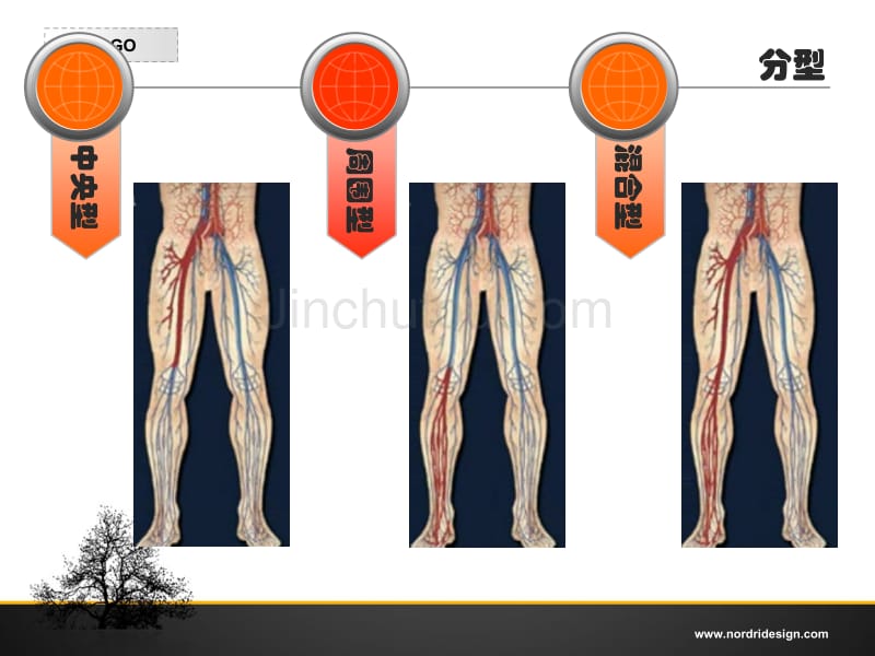 急性下肢深静脉血栓_第4页