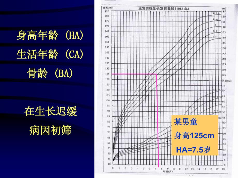 骨龄评估与临床应用_第4页