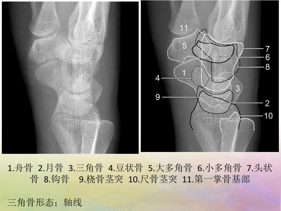 腕关节解剖_第4页