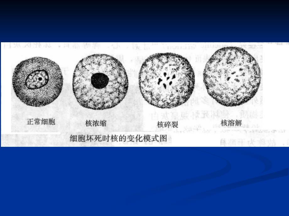 病理学基础_第4页