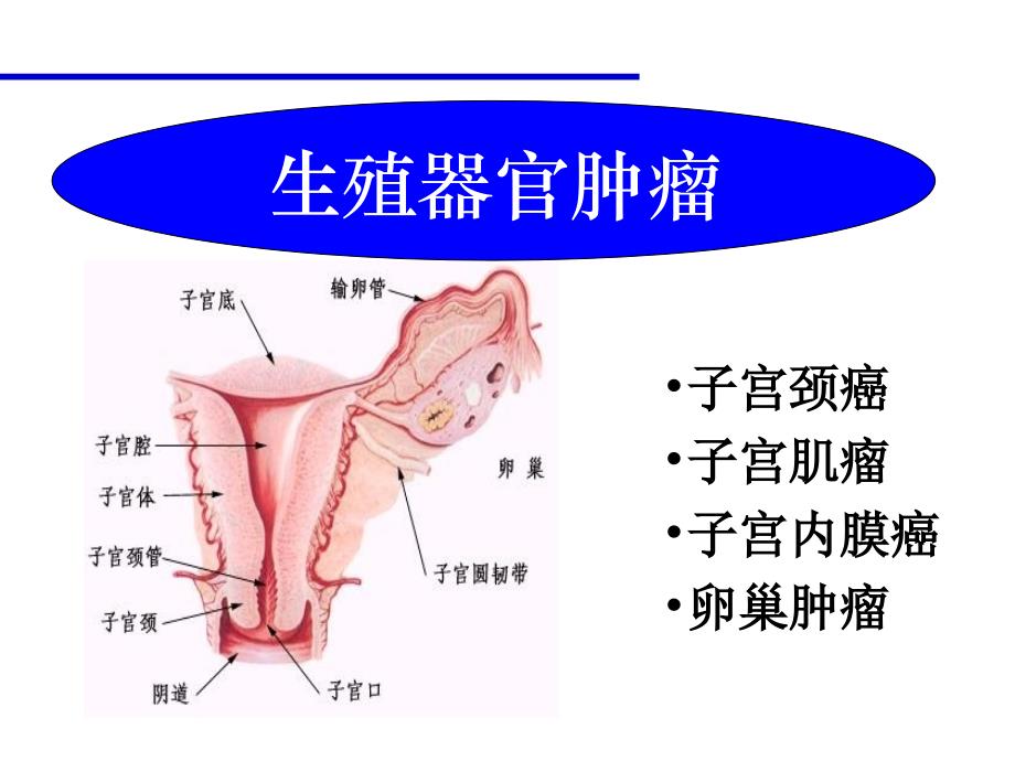 妇产科：宫颈癌_第2页