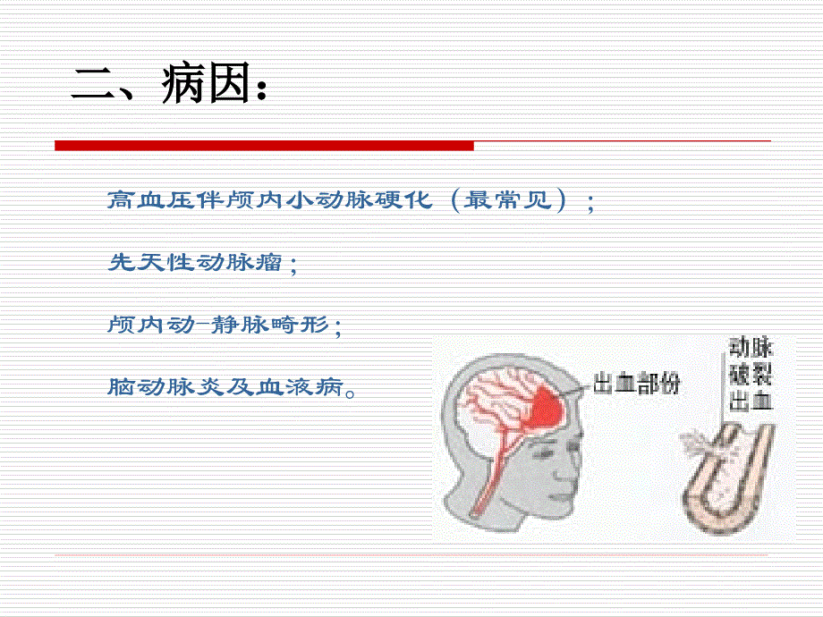 脑出血业务学习_第4页