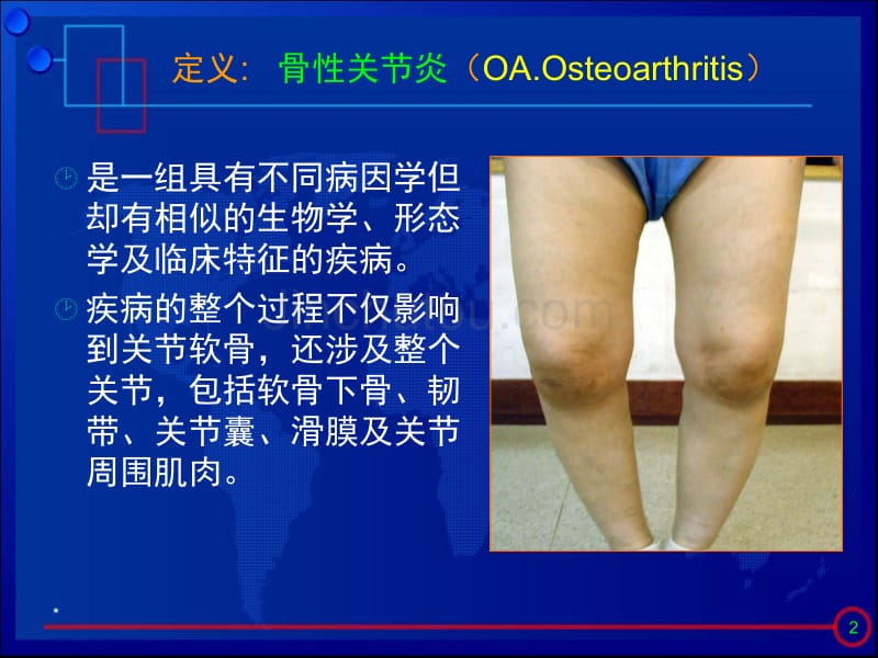 膝关节骨性关节炎诊治进展_第2页