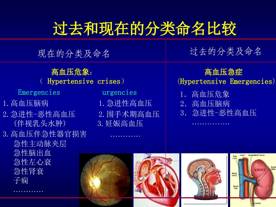 简述高血压危象_第4页