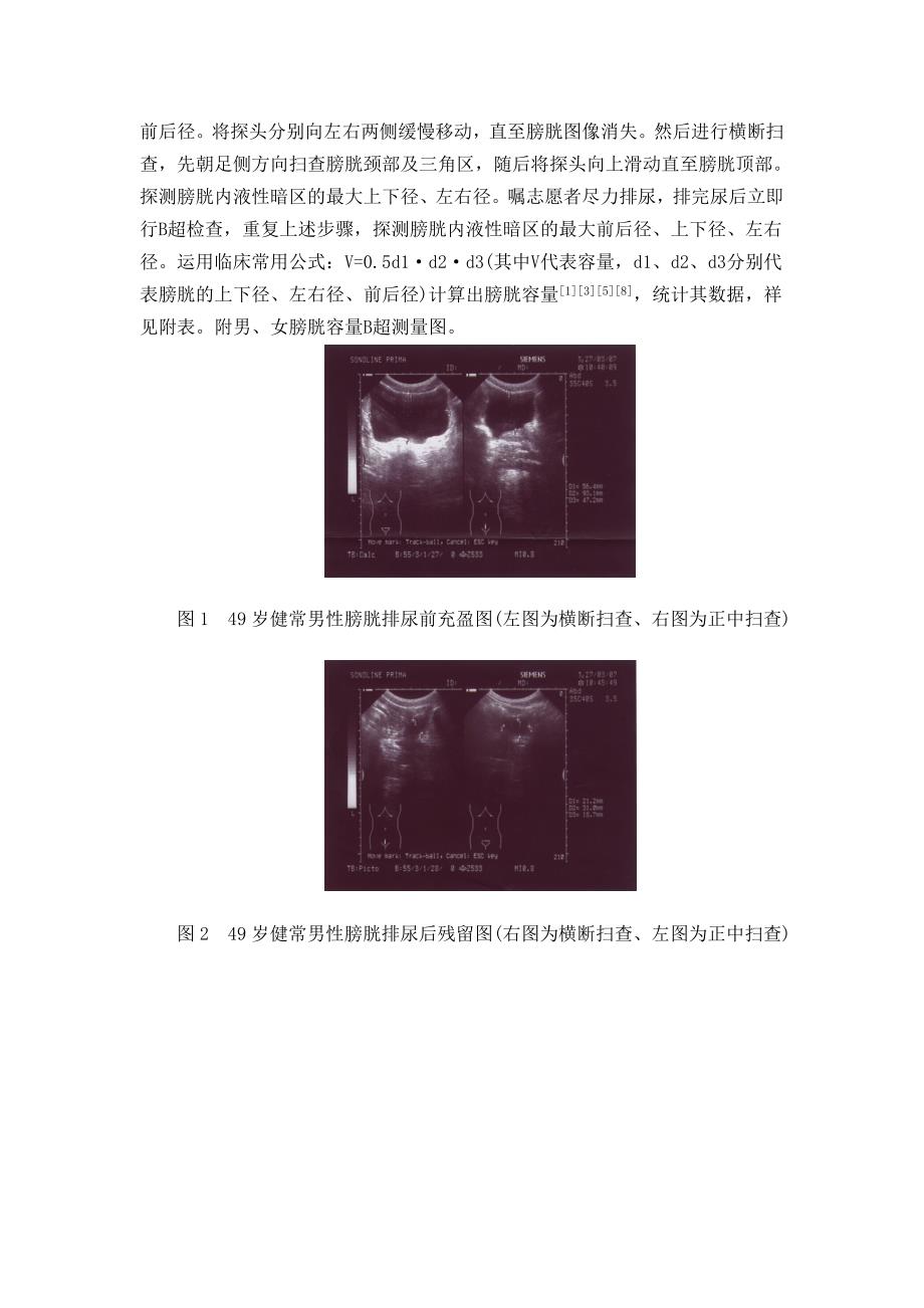 不同年龄段健常成人膀胱残余尿量的比较_第3页