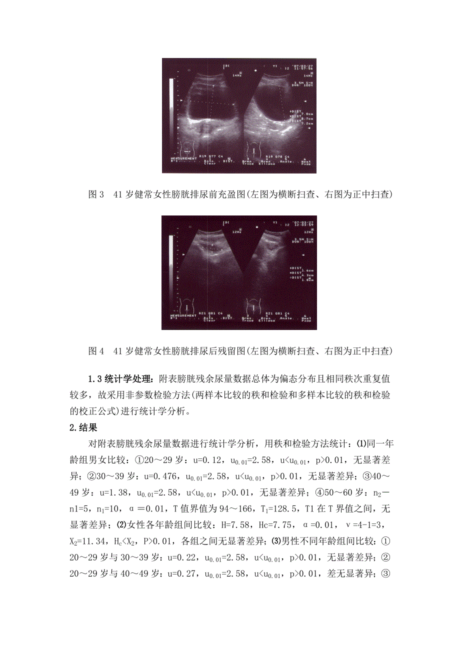 不同年龄段健常成人膀胱残余尿量的比较_第4页