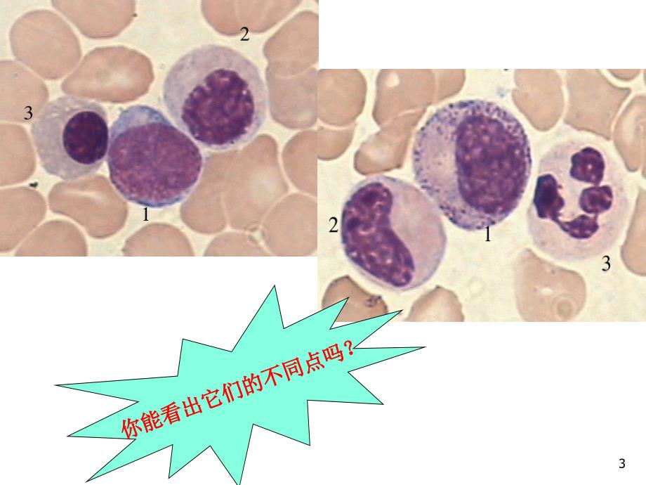 血液学检验,微型课吴芹_第3页