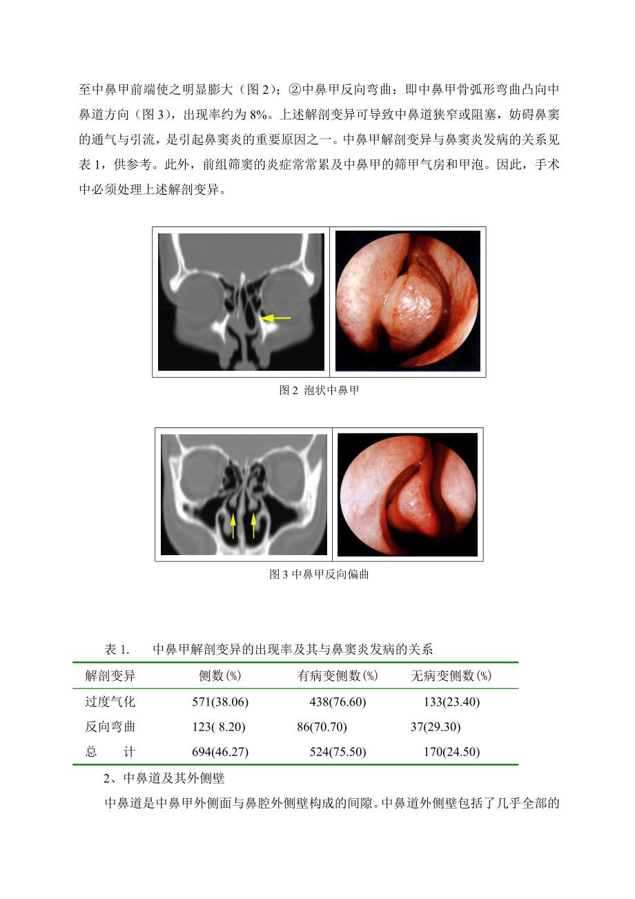 鼻与鼻窦的应用解剖_第3页