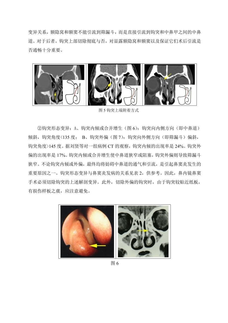 鼻与鼻窦的应用解剖_第5页