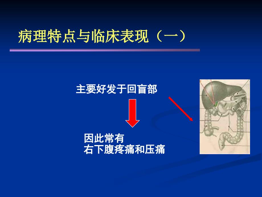 肠结核及结核性腹膜炎1_第3页