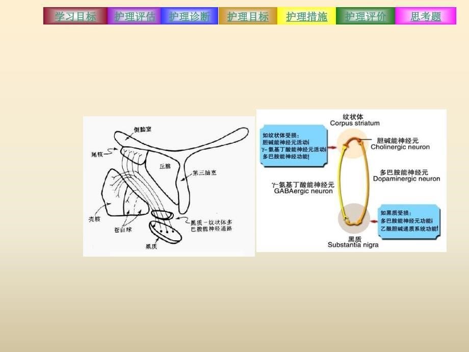 帕金森病病人的护理_第5页