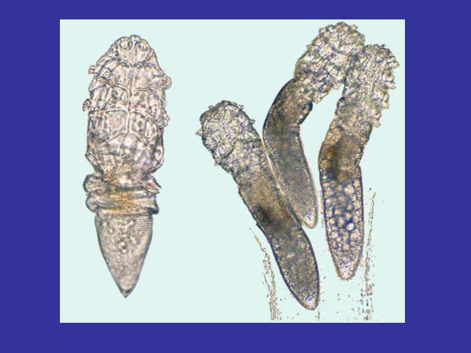 实验三 绦虫 寄生虫实验 教学课件_第1页