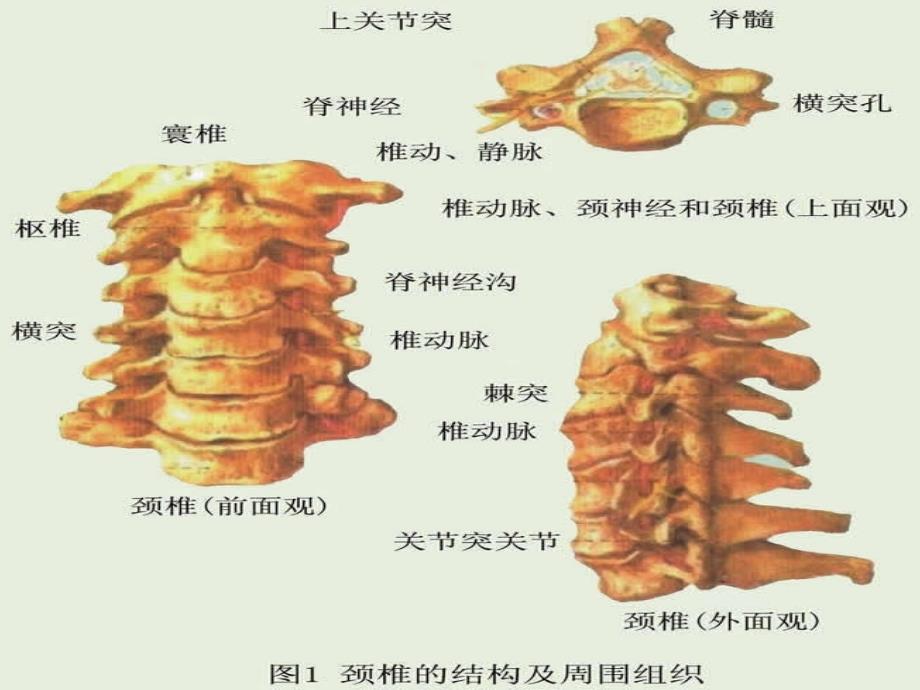 颈椎X线诊断判断椎体退变_第2页