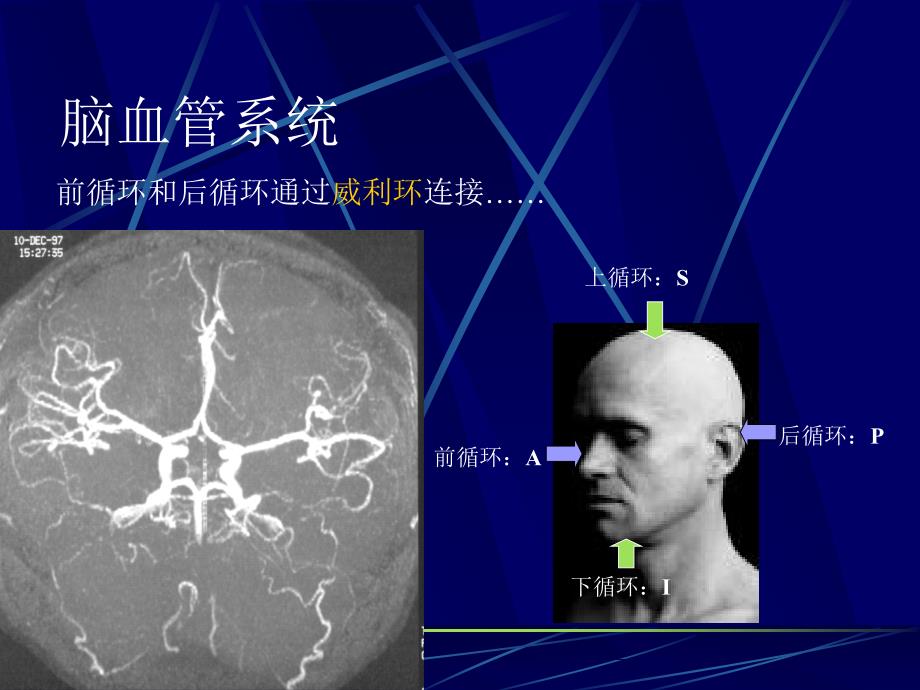 脑血管应用解剖_第4页