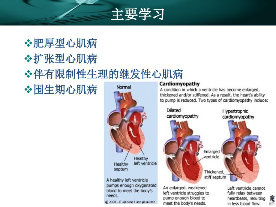 心肌病麻醉_基础医学_医药卫生_专业资料_第4页