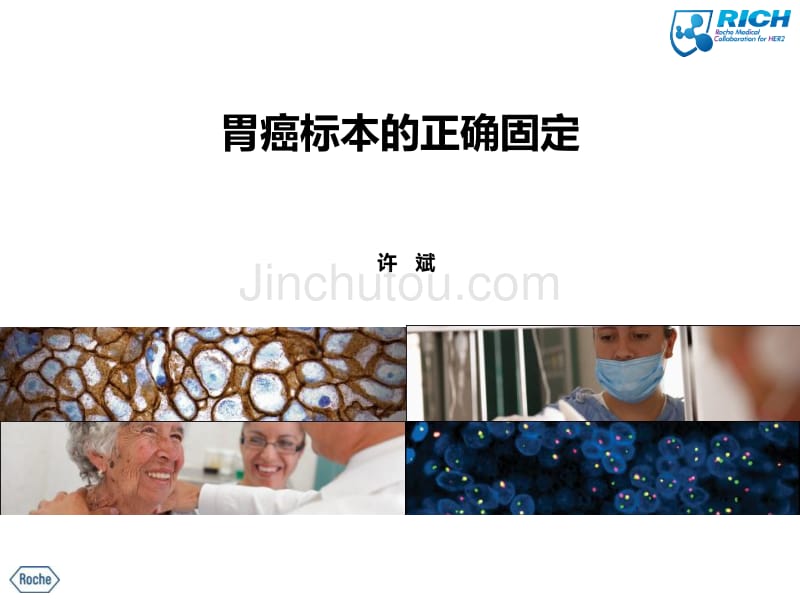 胃癌标本的正确固定许_第1页