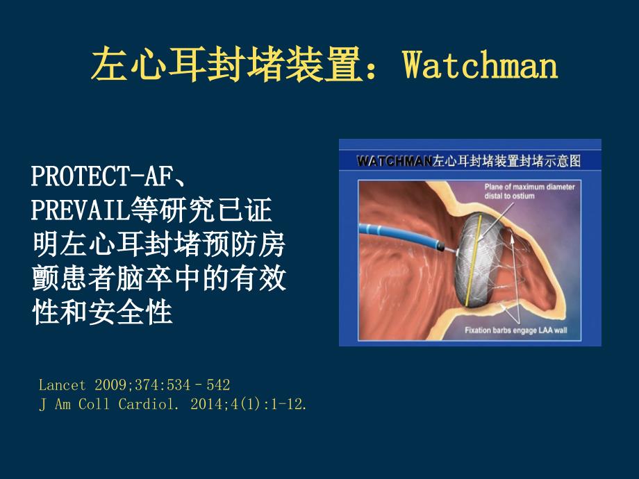 左心耳封堵与新型口服抗凝药伦理答辩_第3页