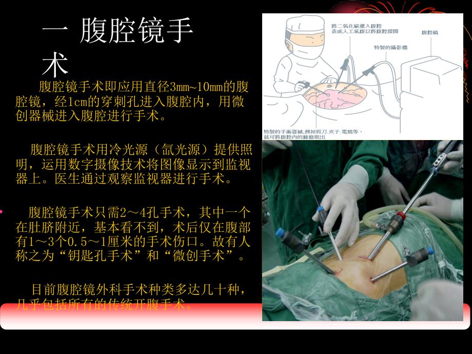 腹腔镜的操作标准_第3页