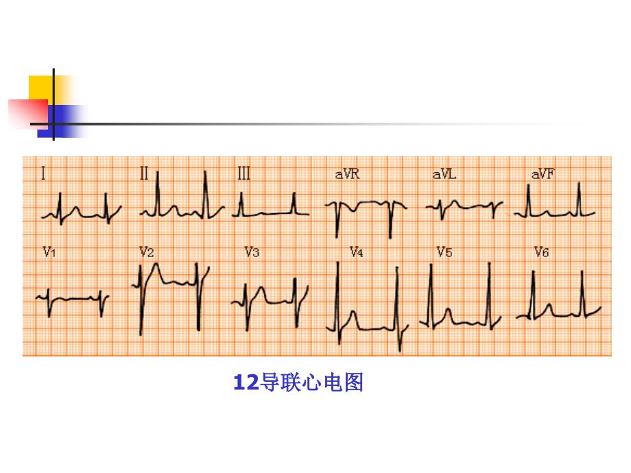 王心电图说文解字一心电图基础知识_第2页