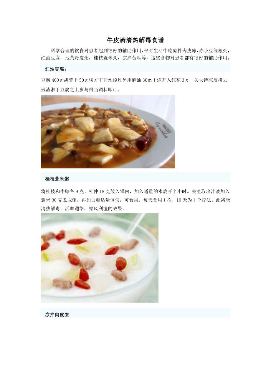 牛皮癣清热解毒食谱_第1页