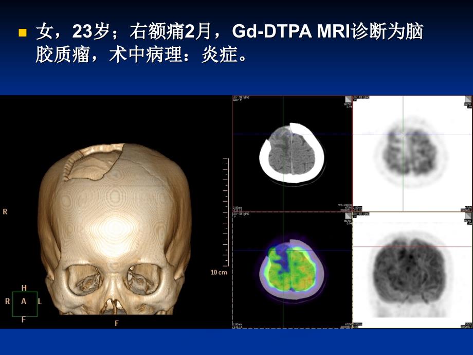 中山肿瘤医院讲座_第3页