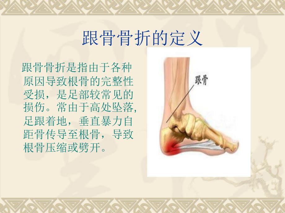 新建跟骨骨折的护理查房_第2页