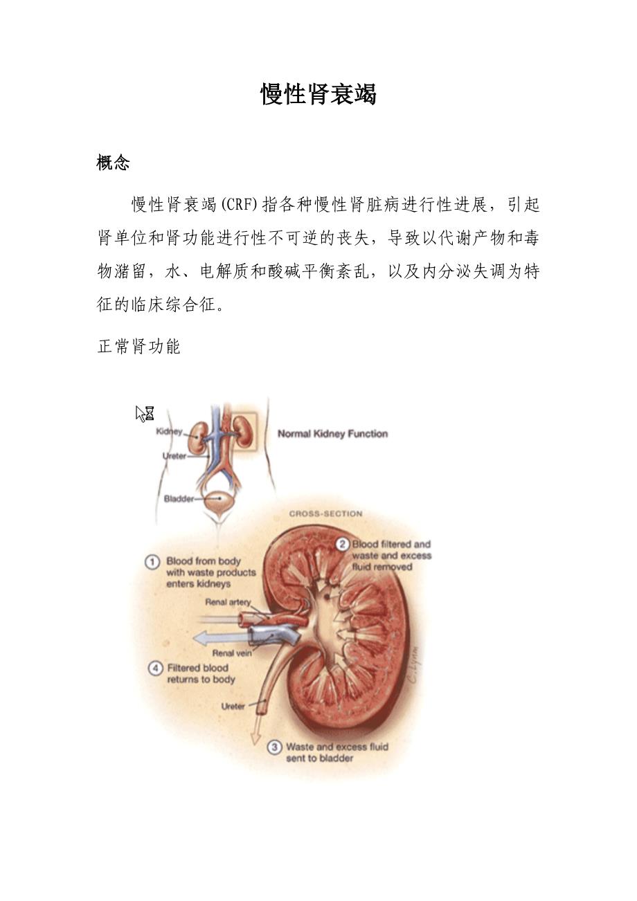 慢性肾衰竭及案例分析_第1页