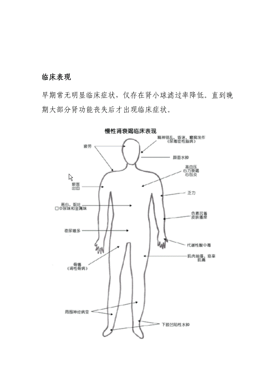 慢性肾衰竭及案例分析_第2页