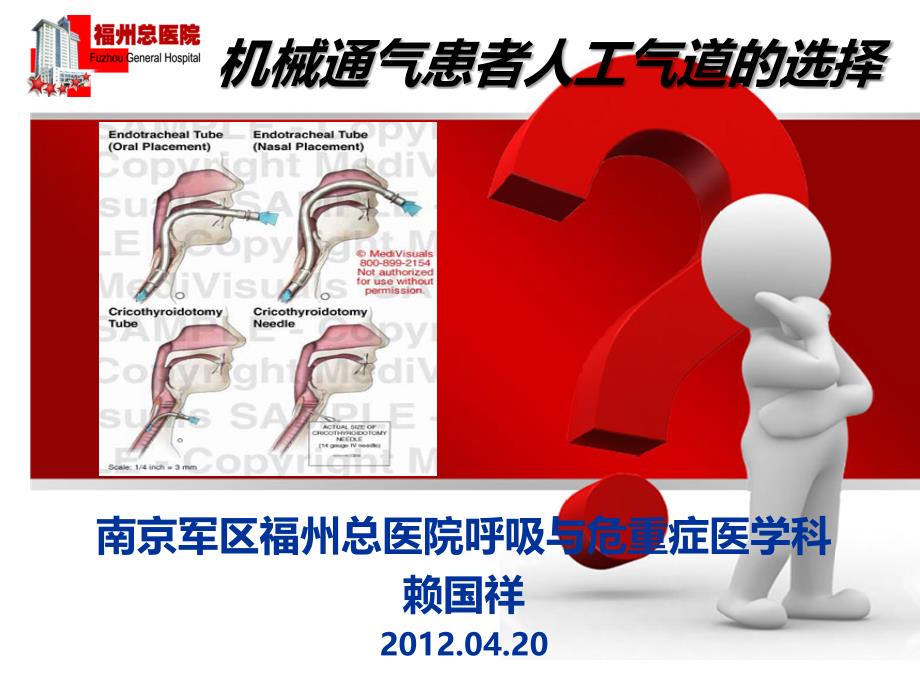 机械通气患者人工气道的选择_第1页