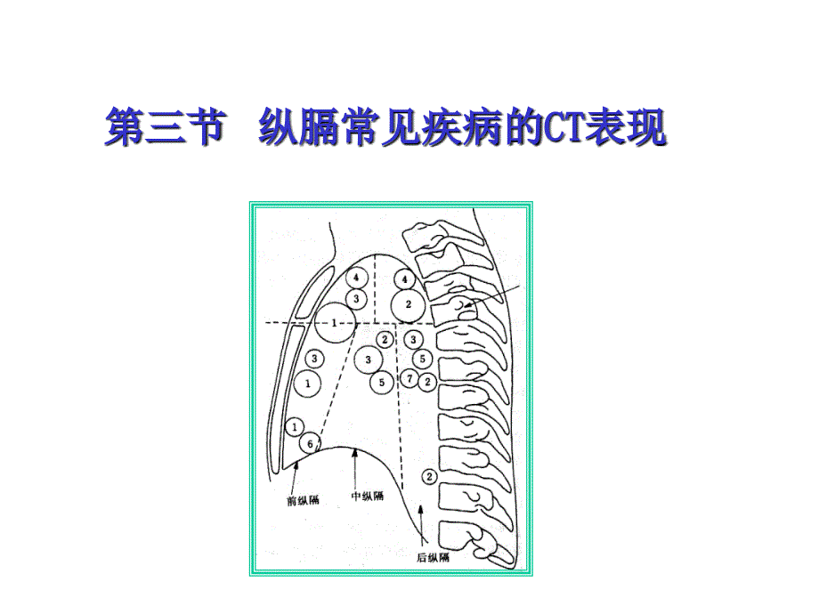 纵隔常见疾病的CT表现_第1页