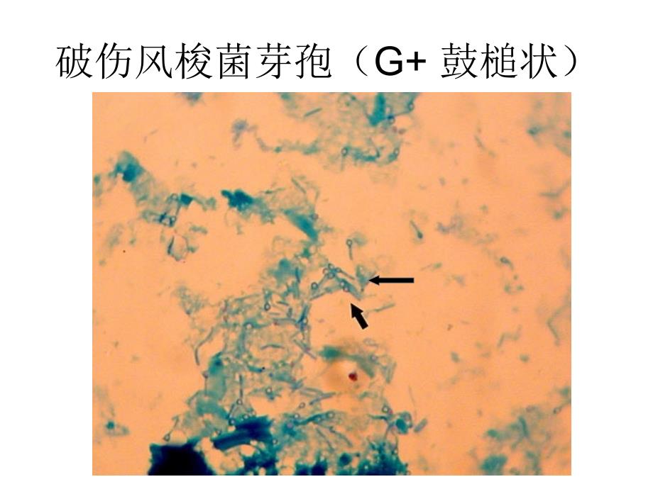 微生物实验标本片汇总_第4页