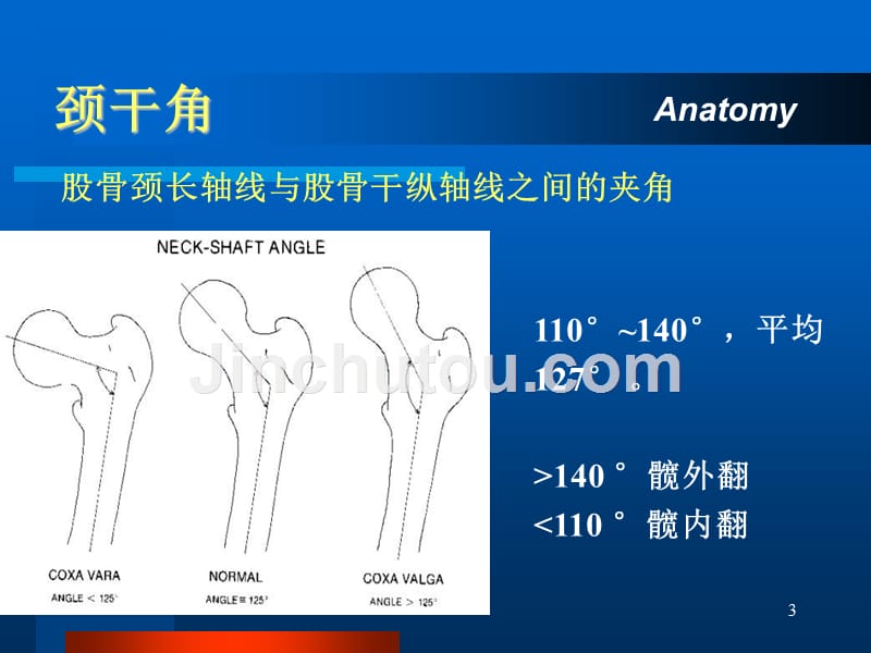 股骨颈骨折陈雪_第3页