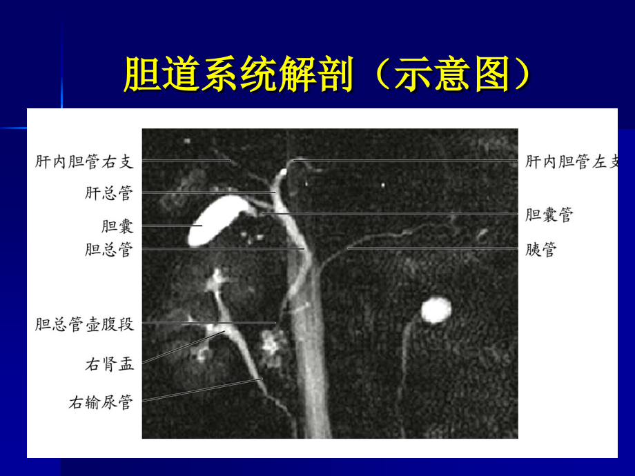 梗阻性黄疸影像诊断史学军_第3页