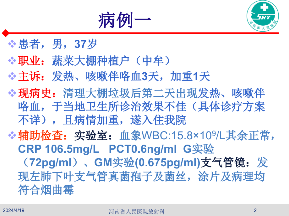 曲霉菌病的诊断_第2页