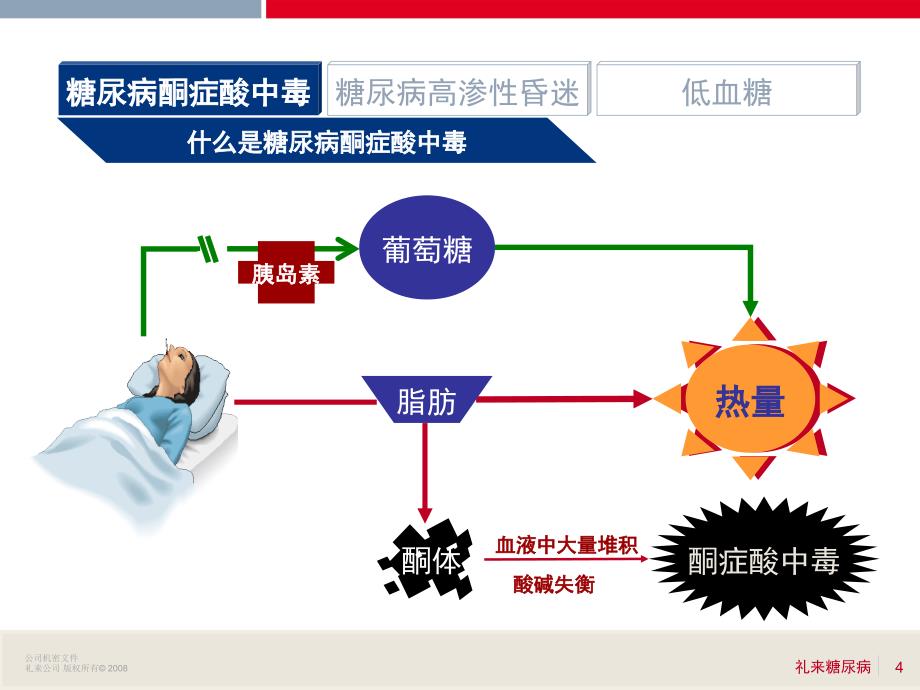 糖尿病并发症的预防_第4页