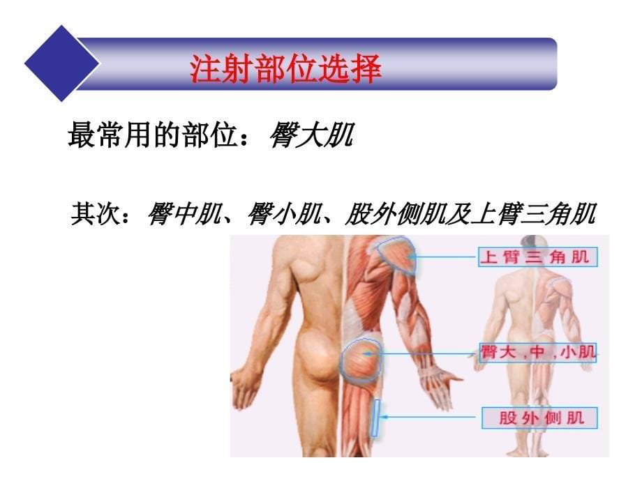 肌肉注射法教学_第5页