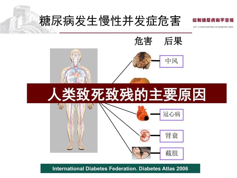 糖尿病流行现状及诊治进展_第5页
