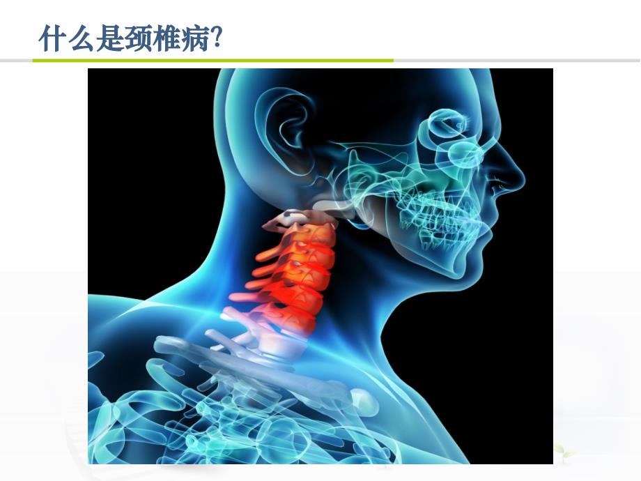 颈椎病康复治疗_第3页