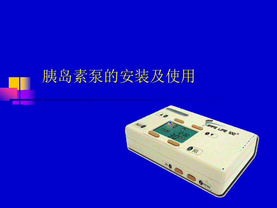 胰岛素泵使用_第1页