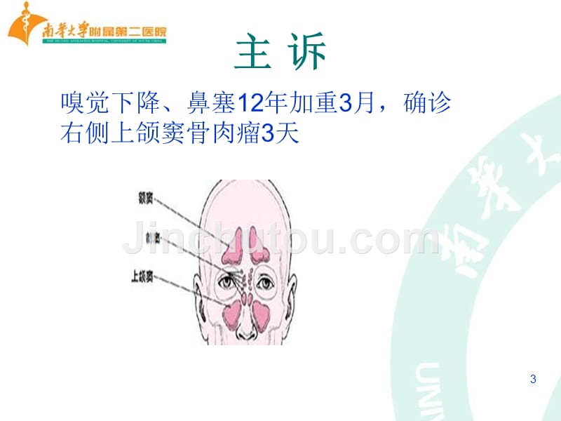 骨肉瘤查房_第3页